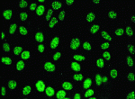 IFT with HEp-2 cells: anti-RNP antibodies show a spreckled pattern.