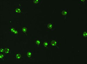 Immunoflurescence image of anti-dsDNA-antibodies for the diagnosis of SLE